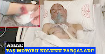 <center> Abana: </center><center><font color=’blue’> TAŞ MOTORU KOLUNU PARÇALADI!</font></center>